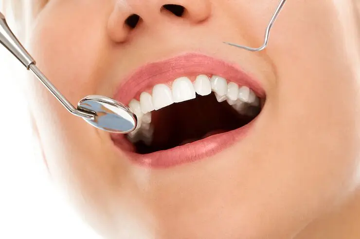 Smile Design