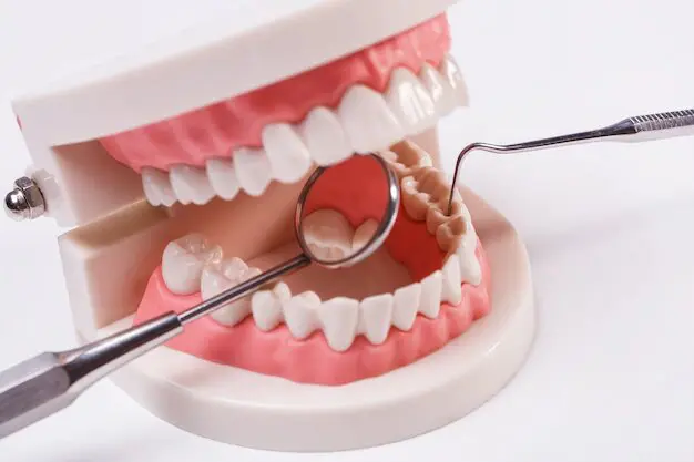 Full Mouth Implant