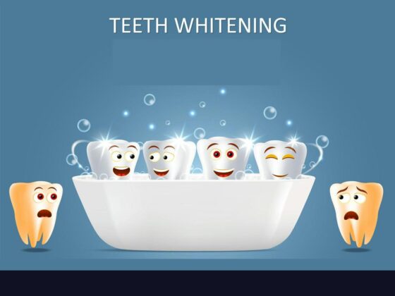 Maintaining Your Sparkling Smile: Post-Whitening Care and Tips