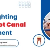 Highlight the root canal treatment