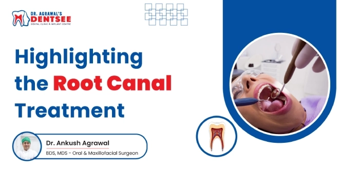Highlight the root canal treatment