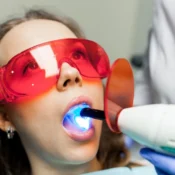 Laser Treatment Good for Your Teeth