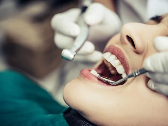 Dental Fillings: Restoring Tooth Damage
