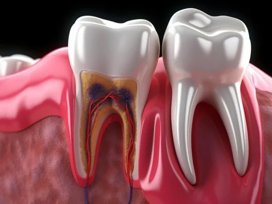 Will I Lose My Tooth After a Root Canal?