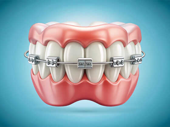 How a Braces Specialist Can Transform Your Smile