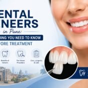 Dental Veneers in Pune: Everything You Need to Know Before Treatment