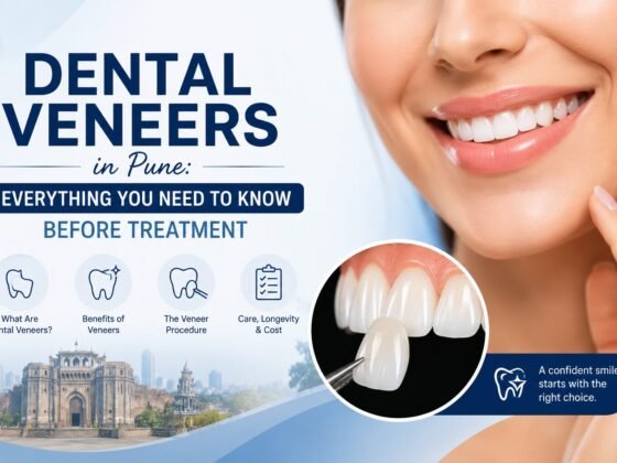 Dental Veneers in Pune: Everything You Need to Know Before Treatment