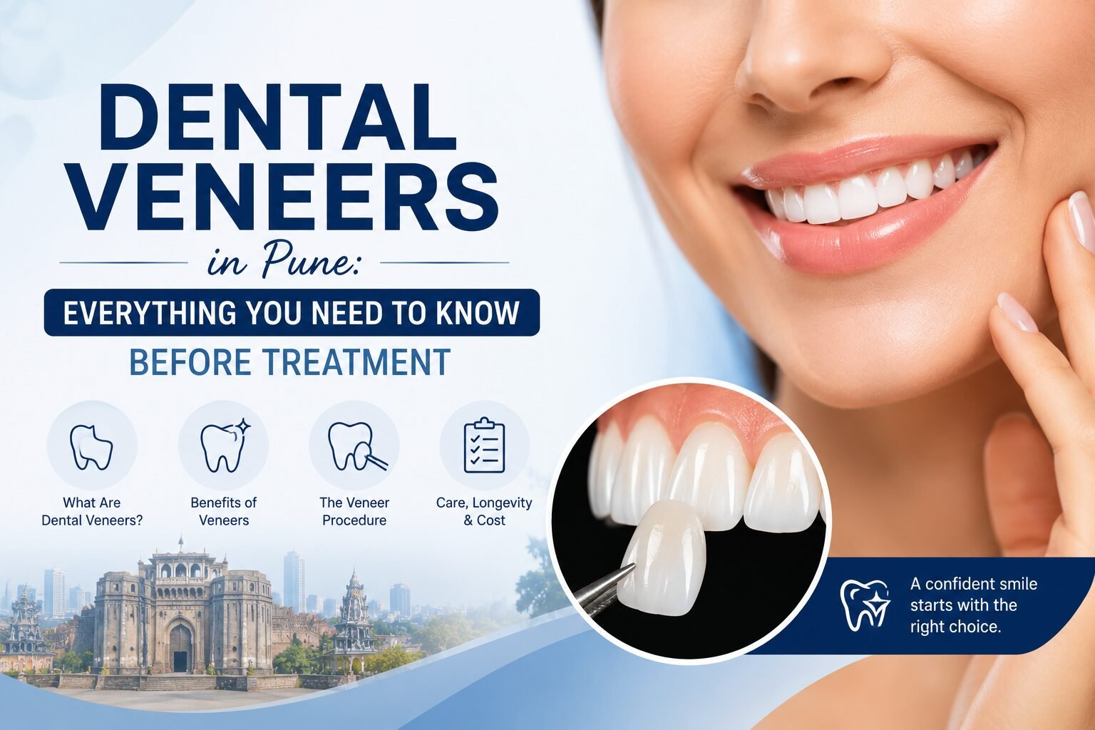 Dental Veneers in Pune: Everything You Need to Know Before Treatment